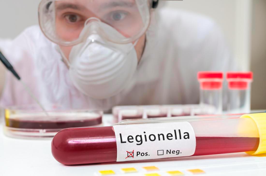 tratamiento-legionella
